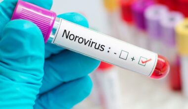 come combattere questa influenza intestinale