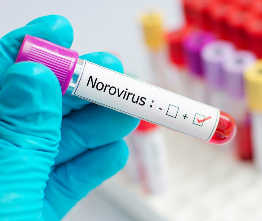 come combattere questa influenza intestinale