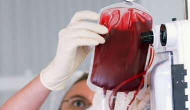 Paziente contrae la cirrosi e muore anni dopo a causa di due trasfusioni: ministero risarcirà familiari