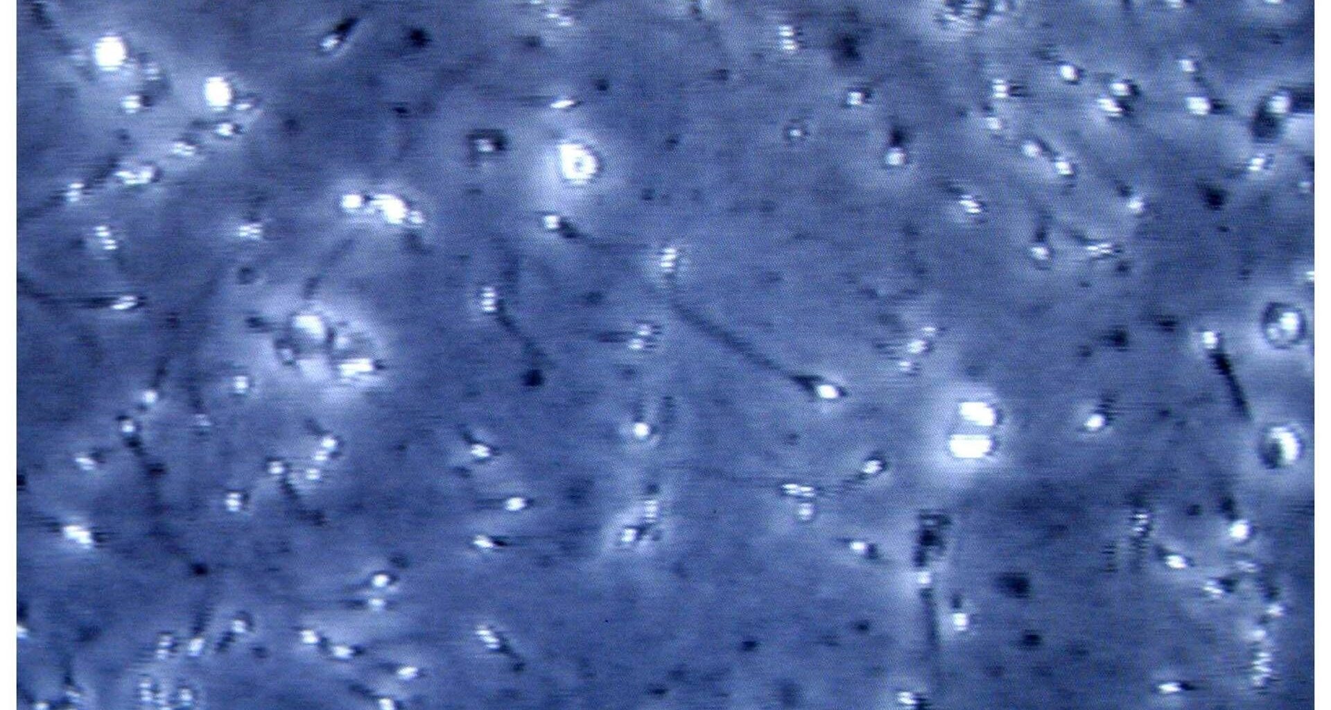 Microplastiche nella prostata e nel liquido seminale, presenti centinaia di particelle: la scoperta italiana