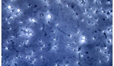 Microplastiche nella prostata e nel liquido seminale, presenti centinaia di particelle: la scoperta italiana