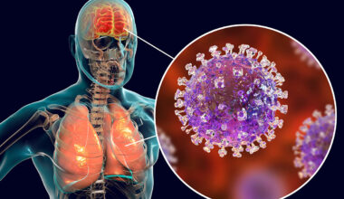 Virus Nipah, cosa sappiamo dell’infezione, come si trasmette, cosa provoca