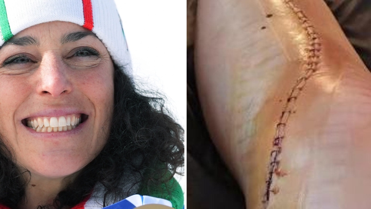 Il rientro di Brignone 10 mesi dopo l'infortunio: la caduta, l'intervento, le placche nella gamba, la riabilitazione