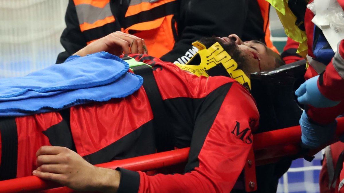 Cosa si è fatto Loftus-Cheek? Entità infortunio e come è andata l'operazione
