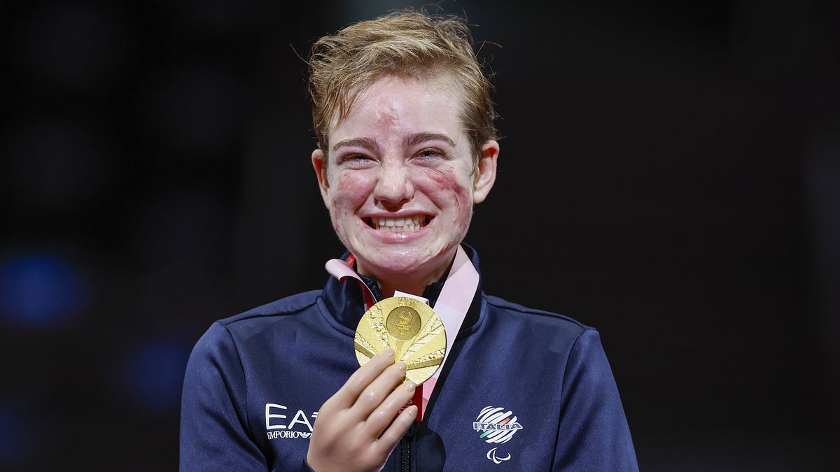 Paralimpiadi, Bebe Vio cambia disciplina: "Lascio la scherma, passo all'atletica e ai 100 metri" - Sportmediaset