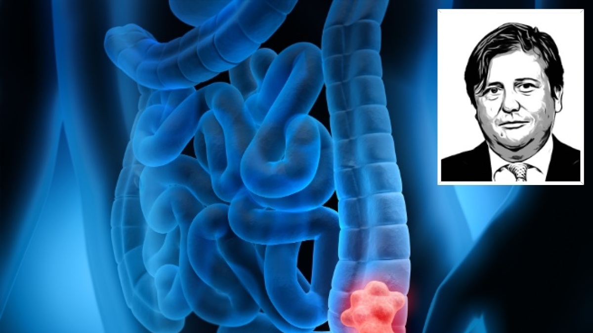 Tumore del colon in aumento: come deve proteggersi chi ha familiari con la malattia?