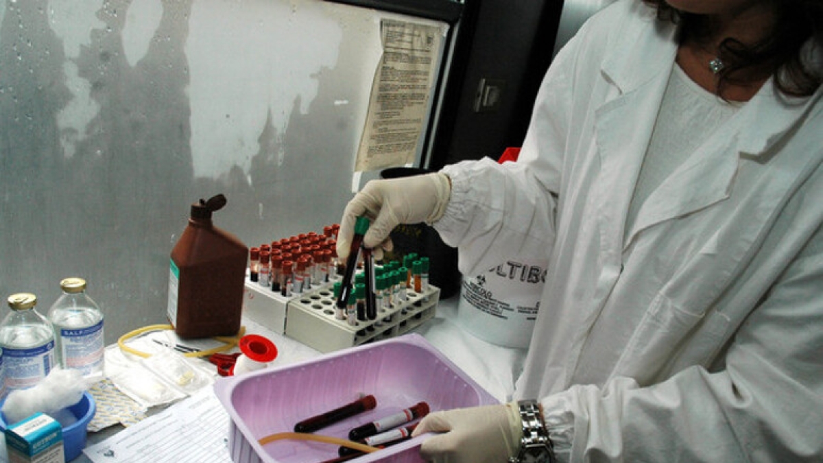 Il virus di Epatite A trovato in alcuni allevamenti flegrei di mitili. L'ipotesi sull'inizio del contagio e la trasmissione da uomo a uomo