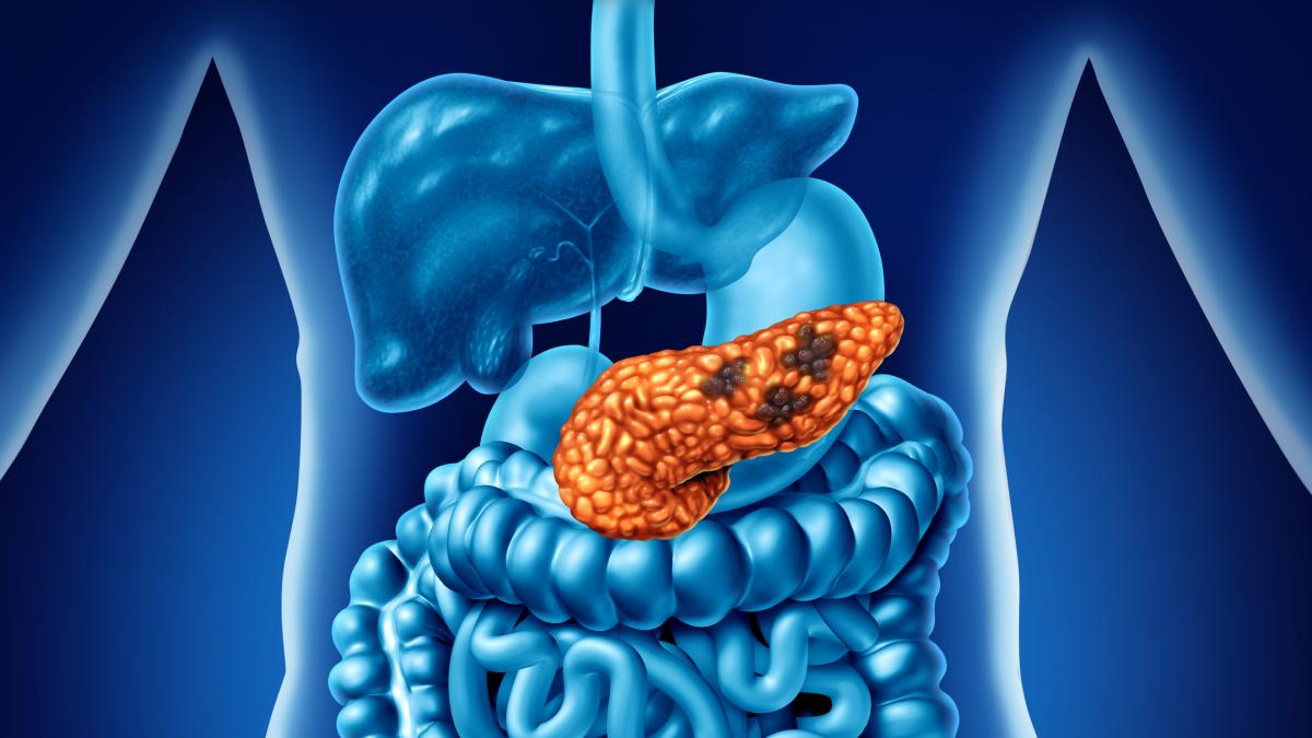 Tumore al pancreas: ritirato lo studio che aveva scoperto una nuova cura per il cancro - La Gazzetta dello Sport