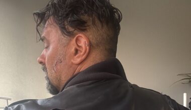 Mauro Marin, ex vincitore del Grande Fratello, rapinato in stazione a Treviso: «Calci e pugni per aver chiesto una sigaretta»