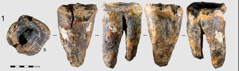 Il dentista di 59.000 anni fa: i Neanderthal trapanavano le carie con strumenti di pietra (e senza anestesia)