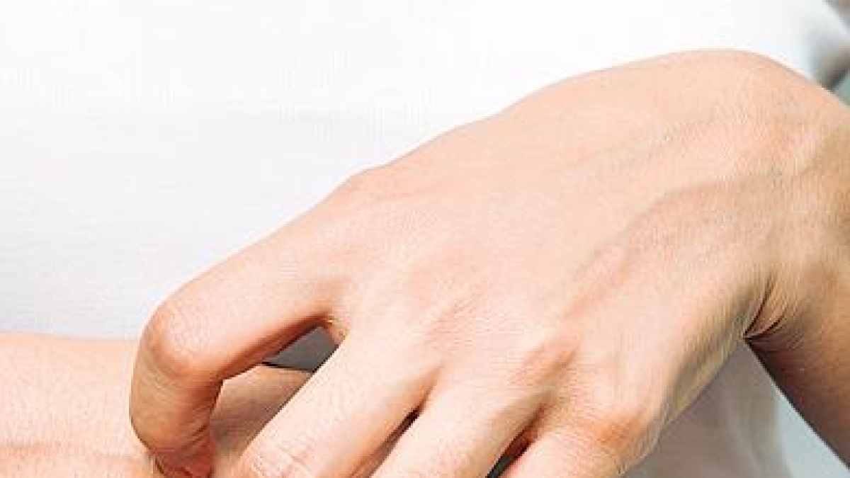 Eczema delle mani: diagnosi e cure disponibili per le forme più gravi. L'impatto sul lavoro