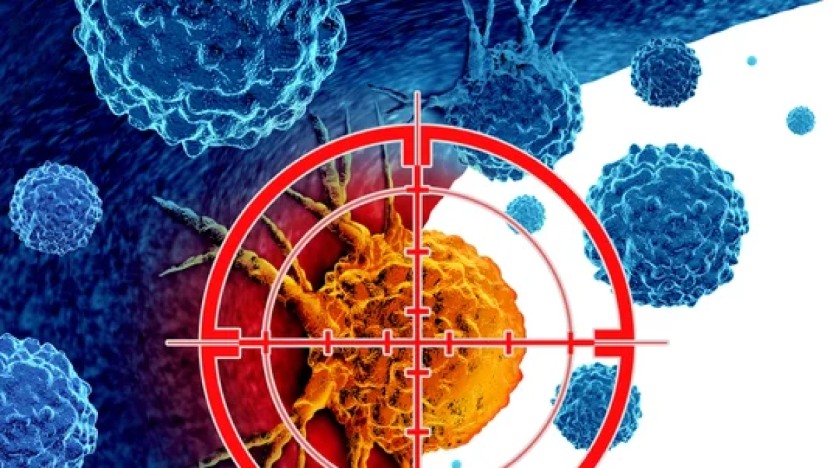Liposarcoma, un farmaco riesce a rallentare il tumore nei pazienti senza altre opzioni di cura efficaci