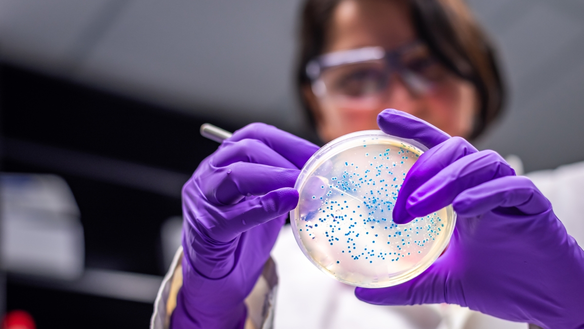 La «nebbia cerebrale» è più frequente tra chi soffre di intestino irritabile