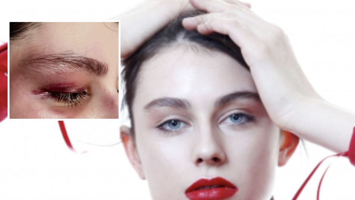 Milano, la modella Anna Aksamit aggredita a Porta Romana: «Circondata e picchiata, stavano per violentarmi. Mi ha salvata un ragazzo, vorrei incontrarlo»