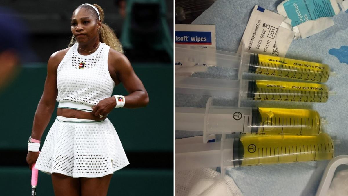 Serena Williams: ginocchio ko, addio Wimbledon. Il messaggio social