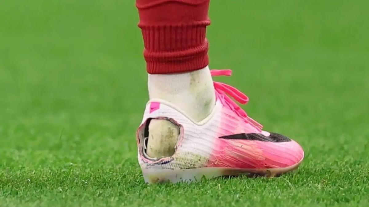 Perché alcuni calciatori hanno gli scarpini bucati? Colpa di una sindrome
