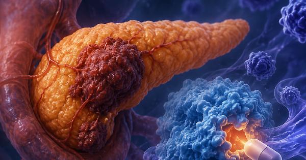 Tumore al pancreas, la pillola che frena il motore della malattia