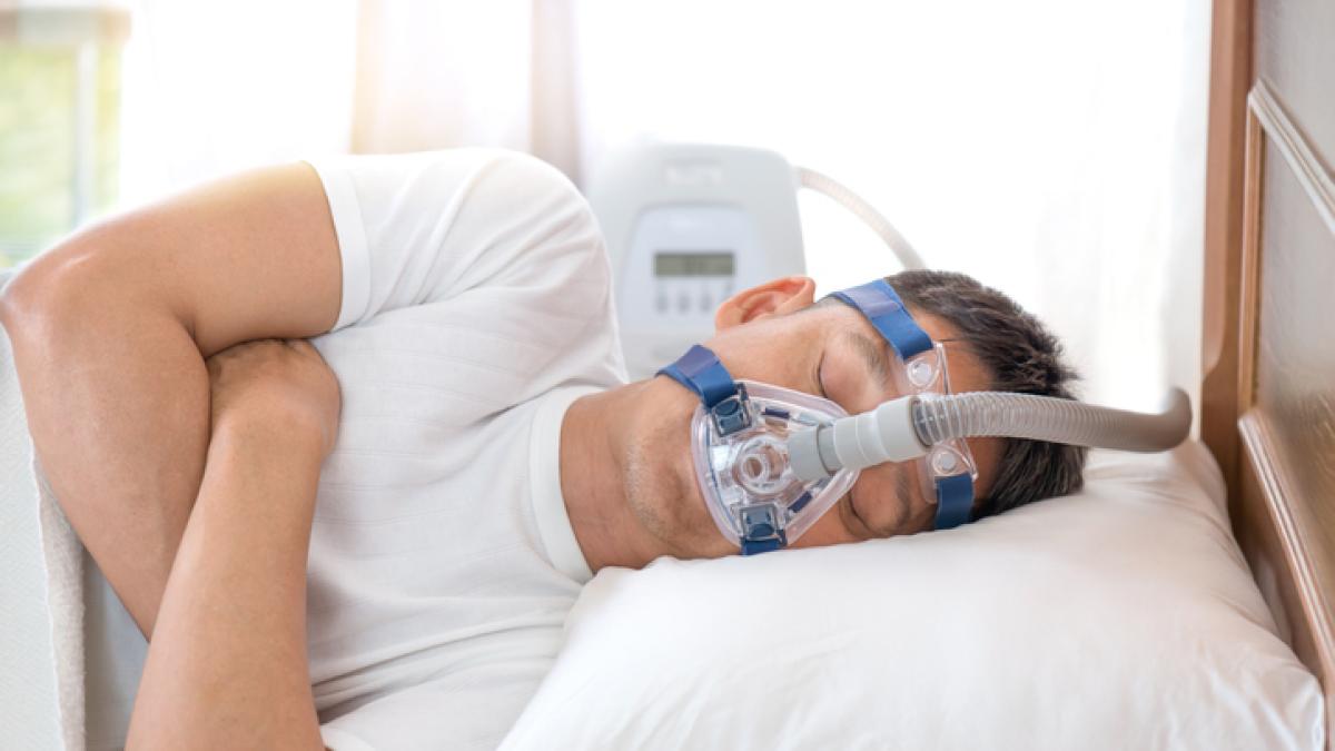 Apnea nel sonno: stimolazione del nervo linguale è una soluzione?