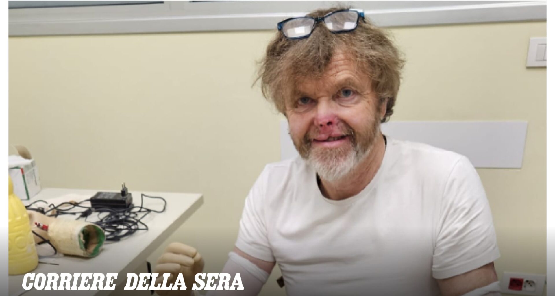 Amputate gambe e braccia dopo la meningite, Sergio Stella l'artigiano di Verona ora ha bisogno di protesi costosissime: «Senza l'infortunio sul lavoro le spese sono tutte a carico mio»