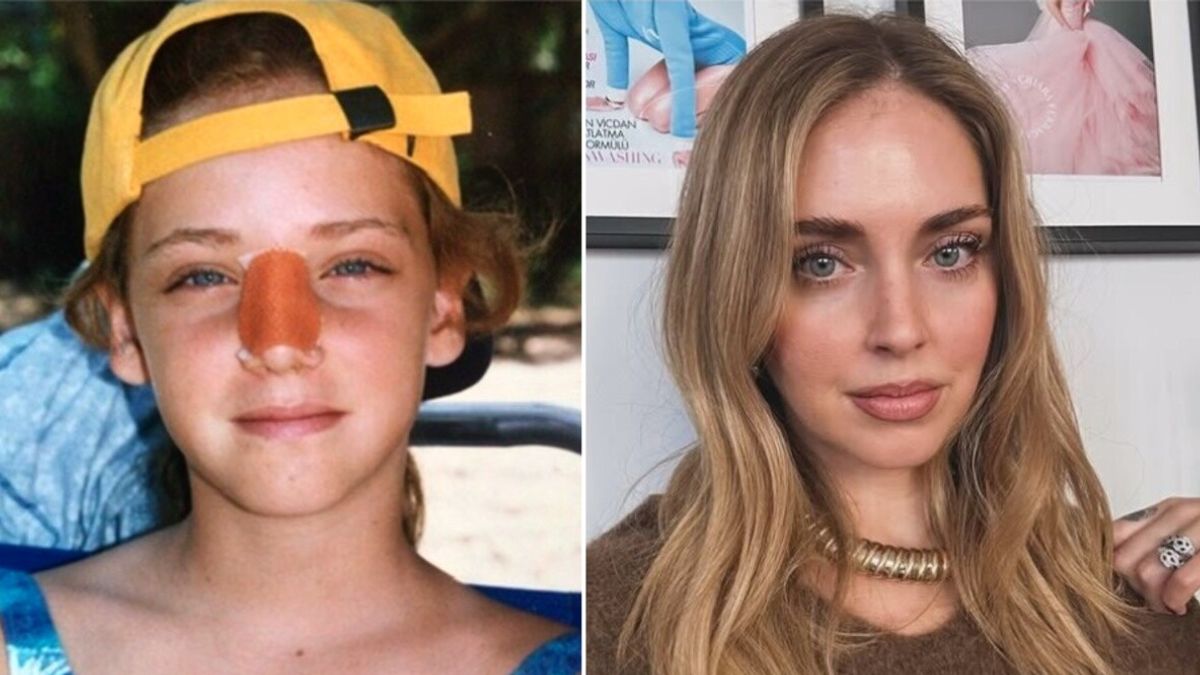 Chiara Ferragni ricorda l'incidente alle Hawaii