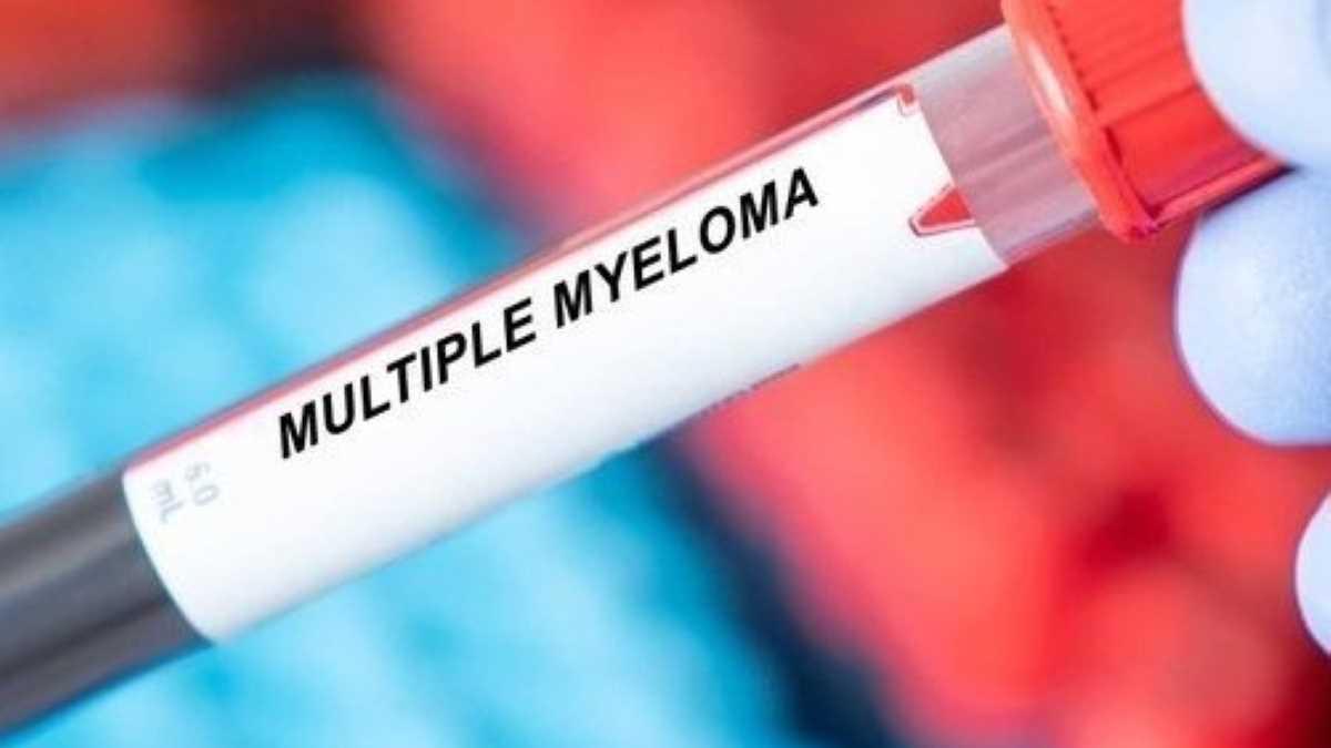 Mieloma multiplo, più progressi negli ultimi cinque anni che nei 25 precedenti: quali sono le cure innovative efficaci
