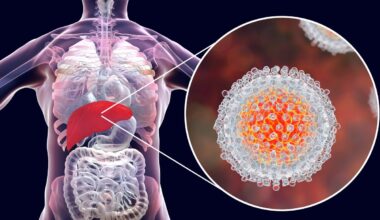 Motyvacija gydyti hepatitą C: kaip įtikinti pacientus?