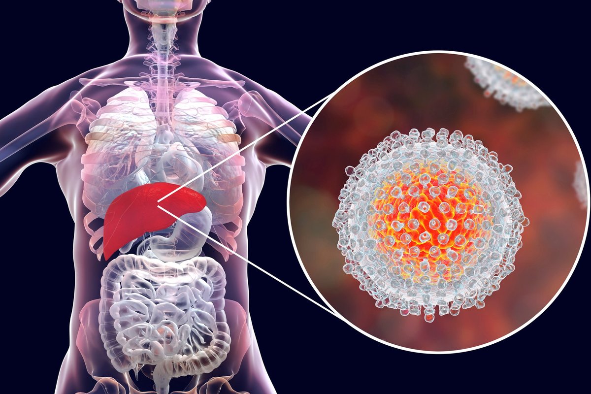 Motyvacija gydyti hepatitą C: kaip įtikinti pacientus?