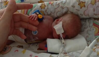 Pateikė daugiau detalių apie antrą pagal mažumą išgyvenusią naujagimę