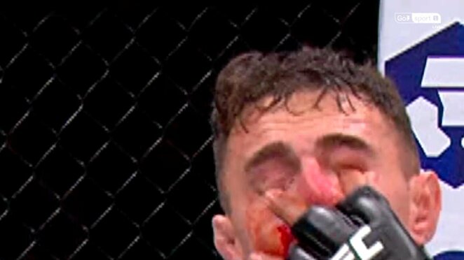 Dūris į Tomo Aspinallio akį | „Stop“ kadras