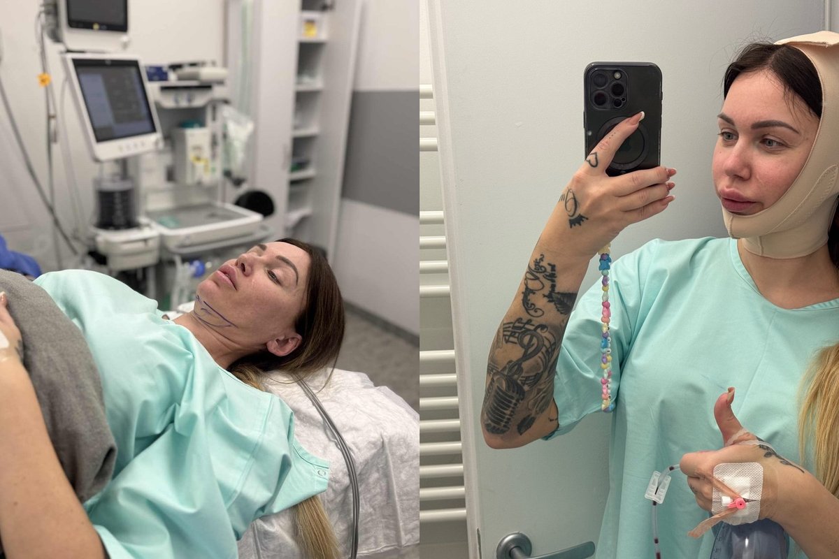 Nuo operacinės stalo vėl pakilusi Justina Partikė: reikia siekti savo svajonių