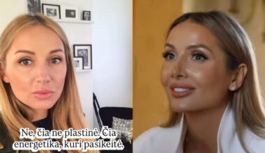 Akivaizdūs Monikos Ra išvaizdos pokyčiai kelia klausimą: tikina, kad tai – kas kita nei plastinė operacija
