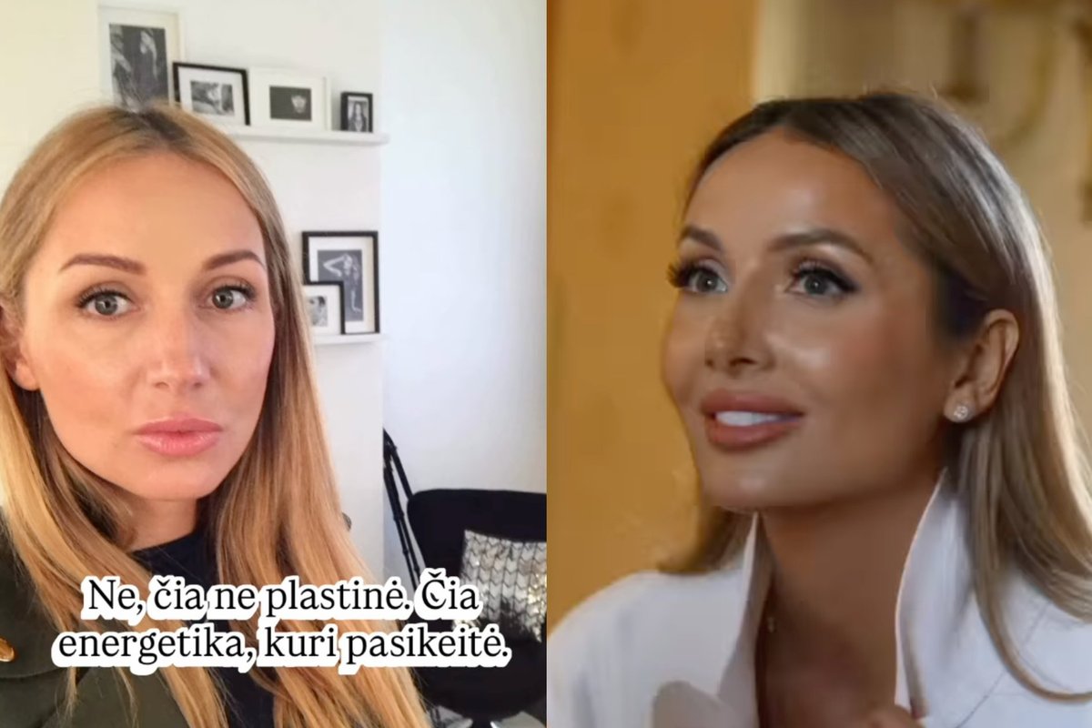Akivaizdūs Monikos Ra išvaizdos pokyčiai kelia klausimą: tikina, kad tai – kas kita nei plastinė operacija