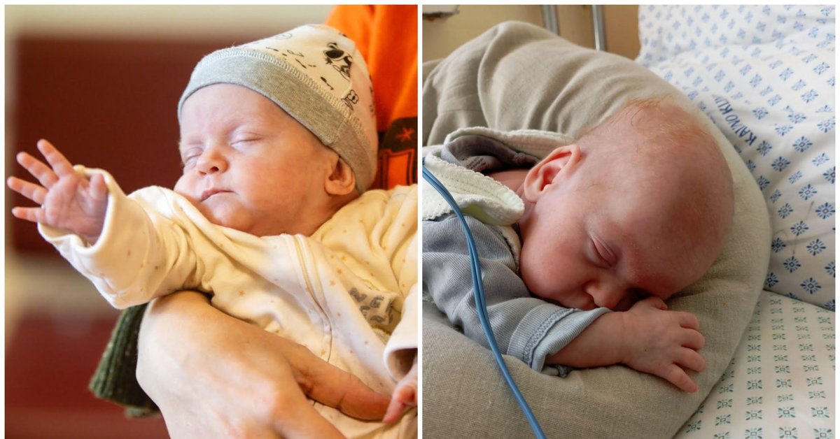 Kauno klinikose išgyveno antra pagal mažumą naujagimė Lietuvoje: svėrė tik 390 gramų