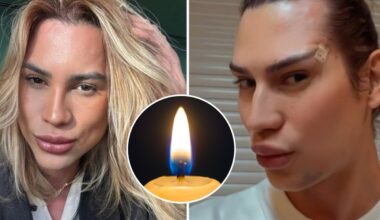 Populiari plastinė operacija baigėsi tragedija: mirė mados influenceris