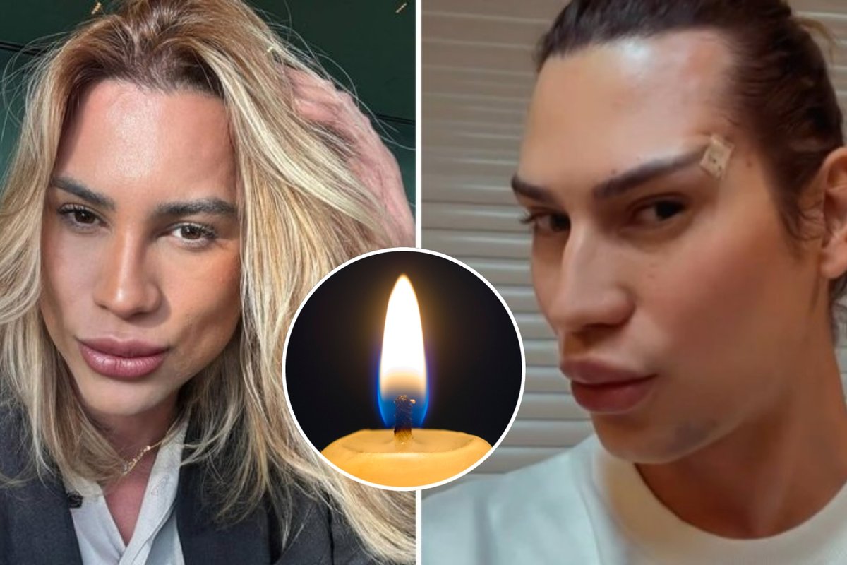 Populiari plastinė operacija baigėsi tragedija: mirė mados influenceris