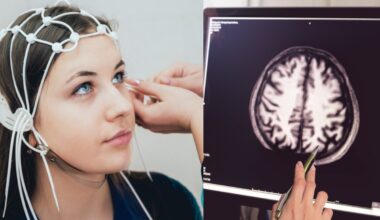 Mokslininkė įspėjo dėl prastėjančios atminties – pasiekus šią ribą bus per vėlu