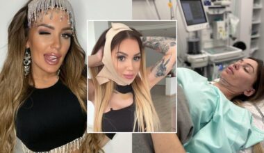 Po operacijos atsigaunanti Justina Partikė parodė nepagražintą realybę