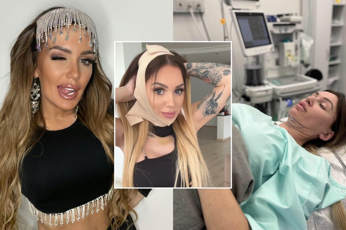 Po operacijos atsigaunanti Justina Partikė parodė nepagražintą realybę