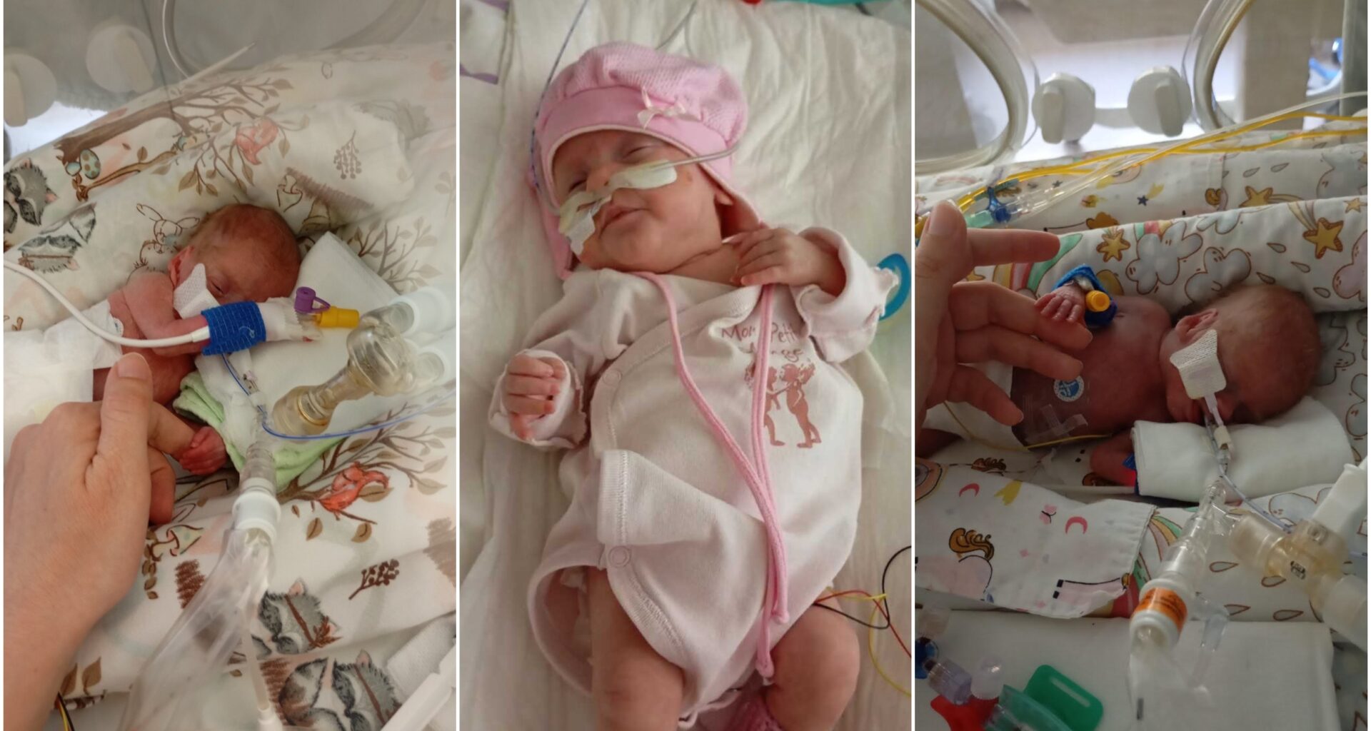 Medikai – apie išgyvenusią rekordiškai mažo dydžio naujagimę: tai sėkmės istorija