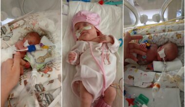 Medikai – apie išgyvenusią rekordiškai mažo dydžio naujagimę: tai sėkmės istorija