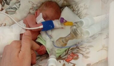 22 savaičių gimusios ir mažiau nei 400 gramų svėrusios Klaudijos stebuklas: „Ji pati rodė, kad nori gyventi“