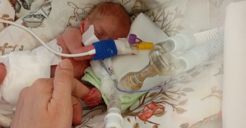 22 savaičių gimusios ir mažiau nei 400 gramų svėrusios Klaudijos stebuklas: „Ji pati rodė, kad nori gyventi“