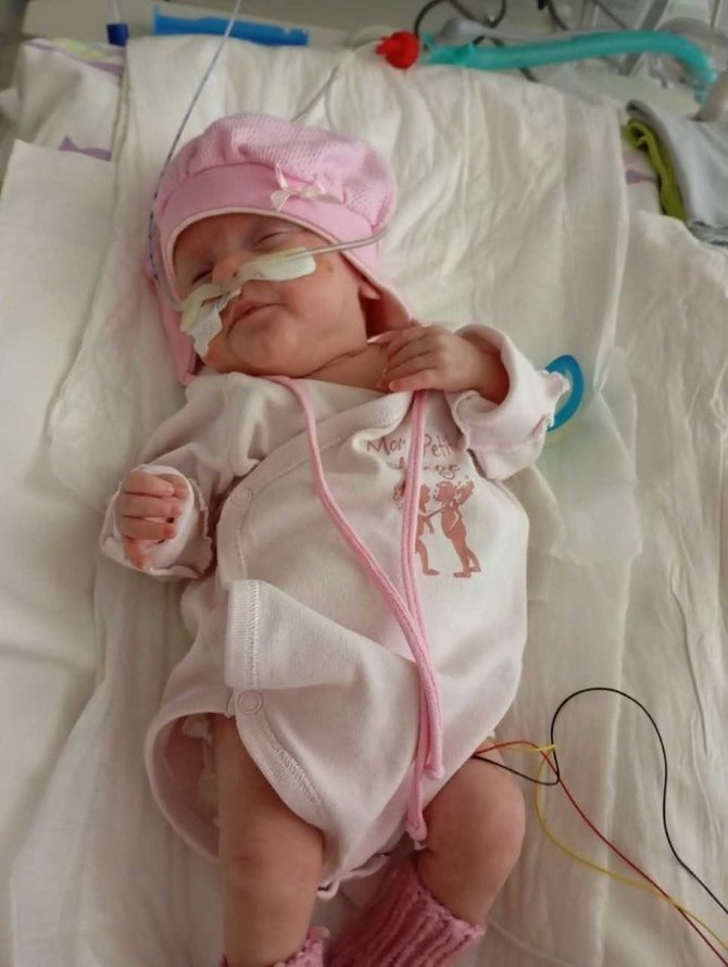Kauno klinikų nuotr. /Klaudija gimė 22 savaičių ir 390 gramų svorio