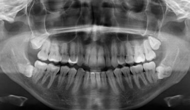 Galvojote, kad dantys yra kaulai? Klystate