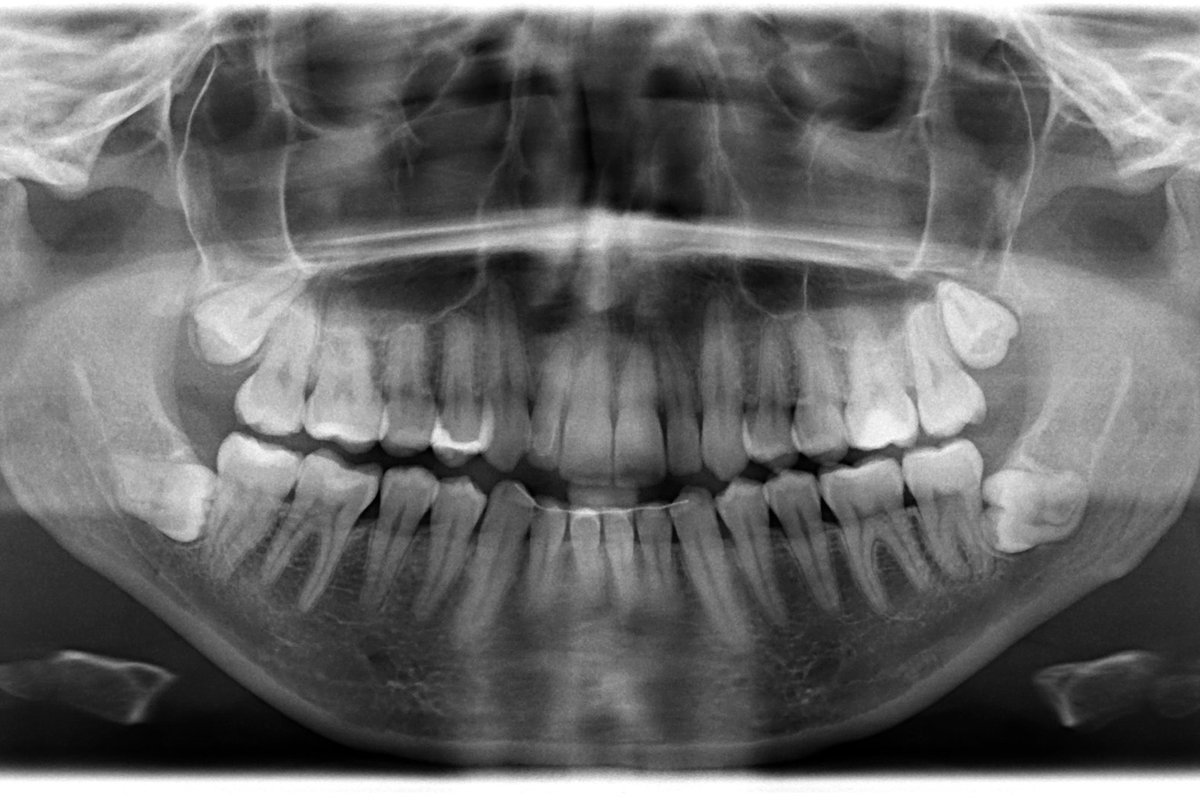 Galvojote, kad dantys yra kaulai? Klystate