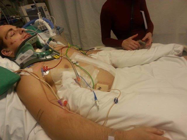 Andrius po išgyventos siaubingos avarijos (nuotr. asm. archyvo)