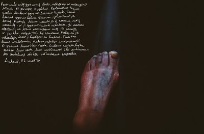 „Nušalusi pėda. Sūnus išvijo motiną iš namų, ji gyveno tvarte. Žiema buvo ypač šalta. Mama nušalo pėdas. Ją rado žmonės, kai ji šliaužė į autobusų stotelę ieškodama pagalbos.“ Aut. Alexander Vasukovich 