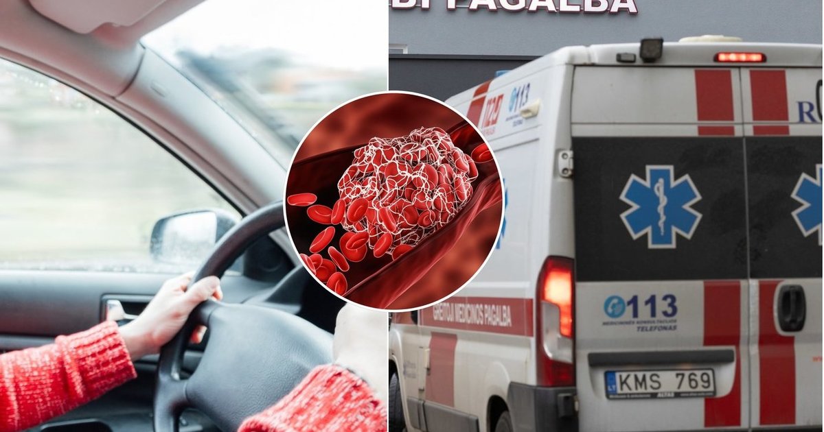 Vyras sąmonę 2 kartus prarado prie vairo – medikai perspėja, kad grėsmingo sutrikimo galima net nejausti
