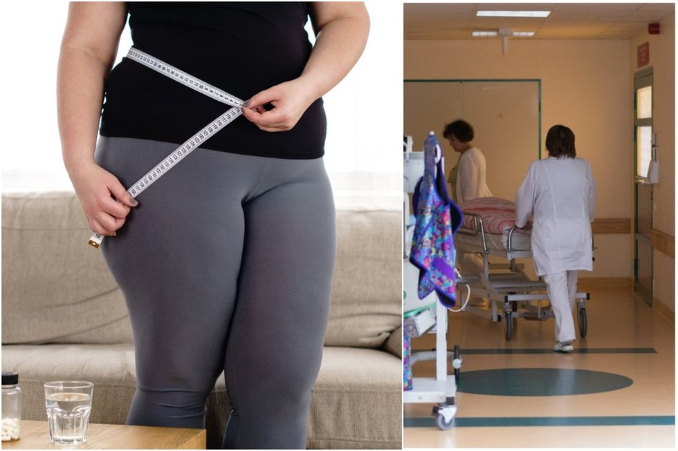 Nutukimas (123rf/BNS nuotr.)