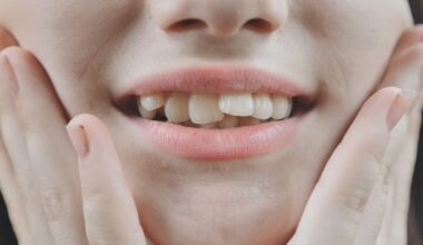 Pirminiai ortodontiniai aparatai pacientams bus kompensuojami